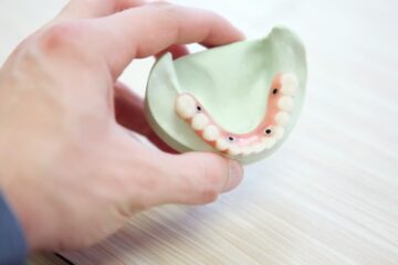 Ce spun studiile despre implanturile dentare?