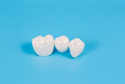 Ce sunt coroanele dentare și când se utilizează?